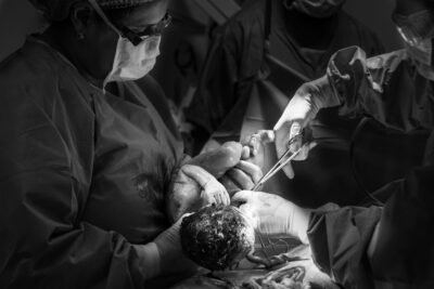 Healing After C-Section: Warm Tips From a Fellow Mom